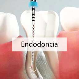 Endodoncia