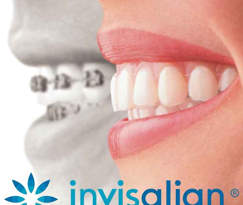 Invisalign