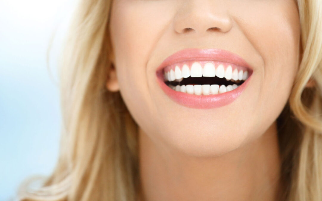 ¿Qué es la estética dental?