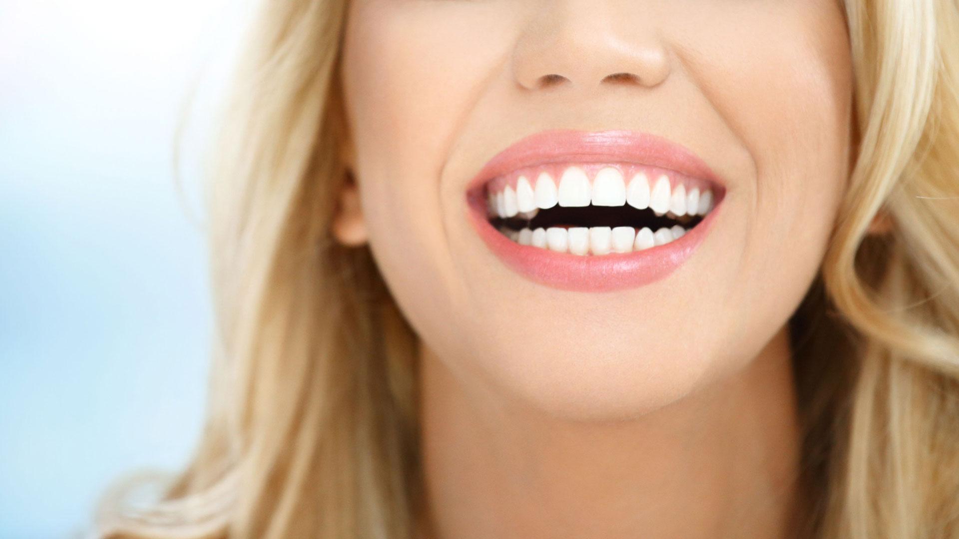 Implante dental