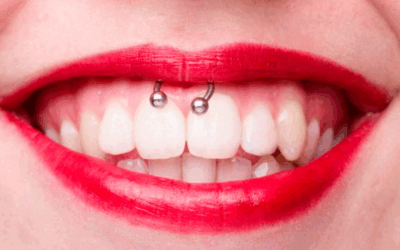 Piercings y problemas dentales