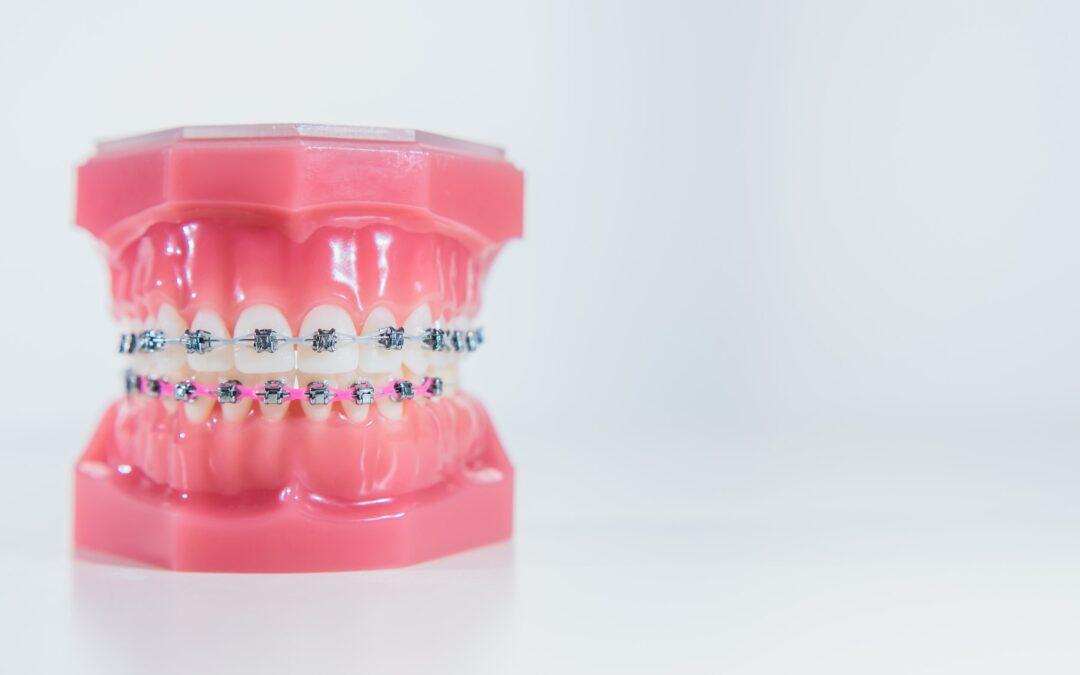 Tipos de dientes y sus funciones