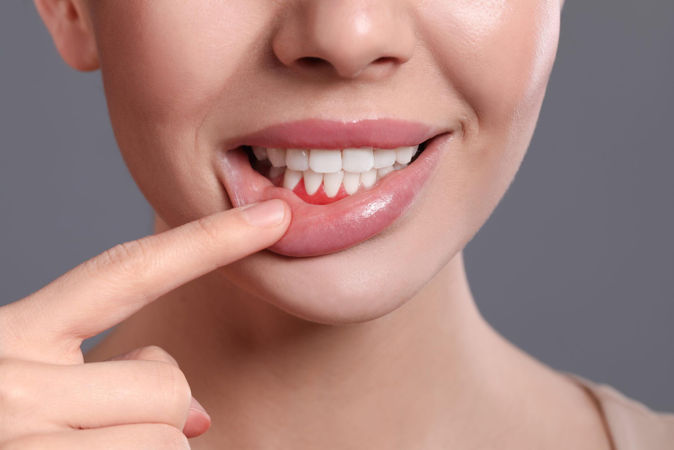 Implante dental