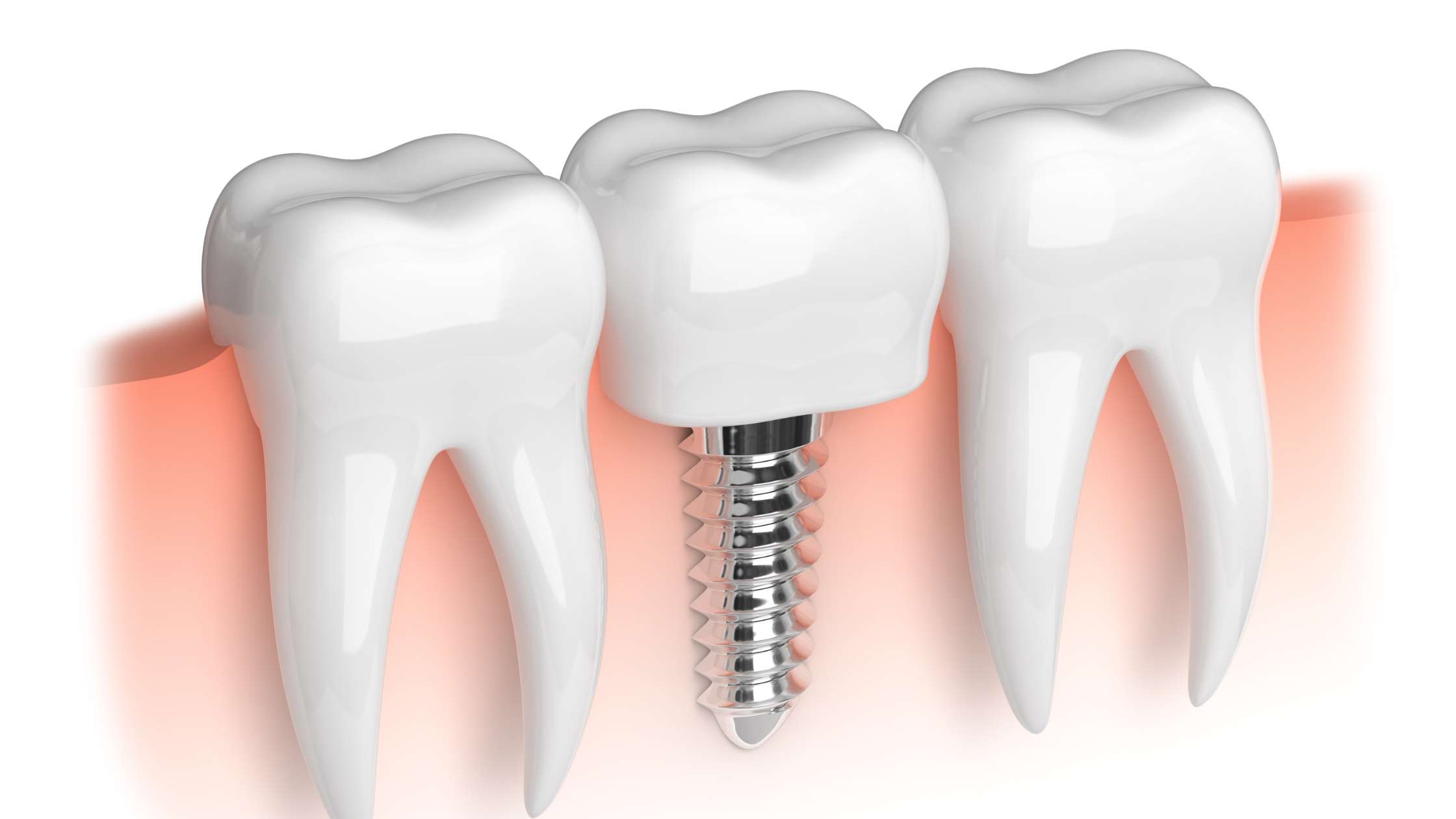 cepillo de dientes