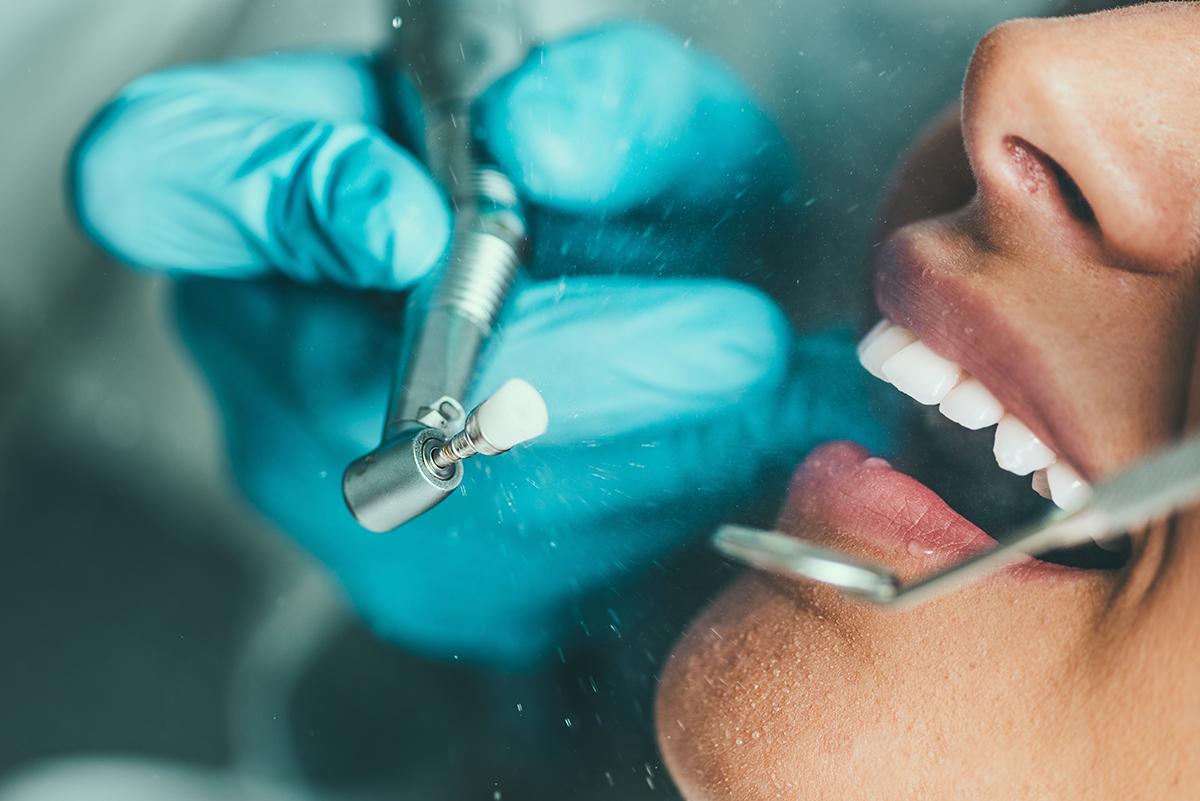 cepillo de dientes