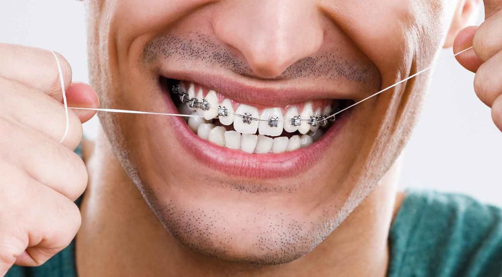 Implantes cirugía guiada