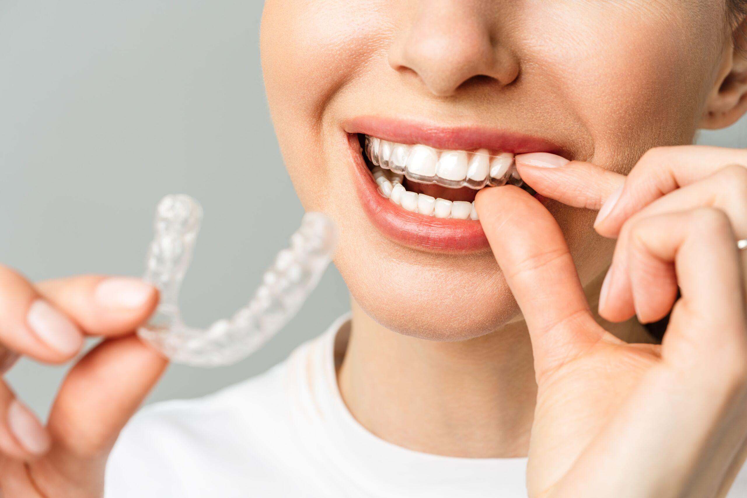 cepillo de dientes